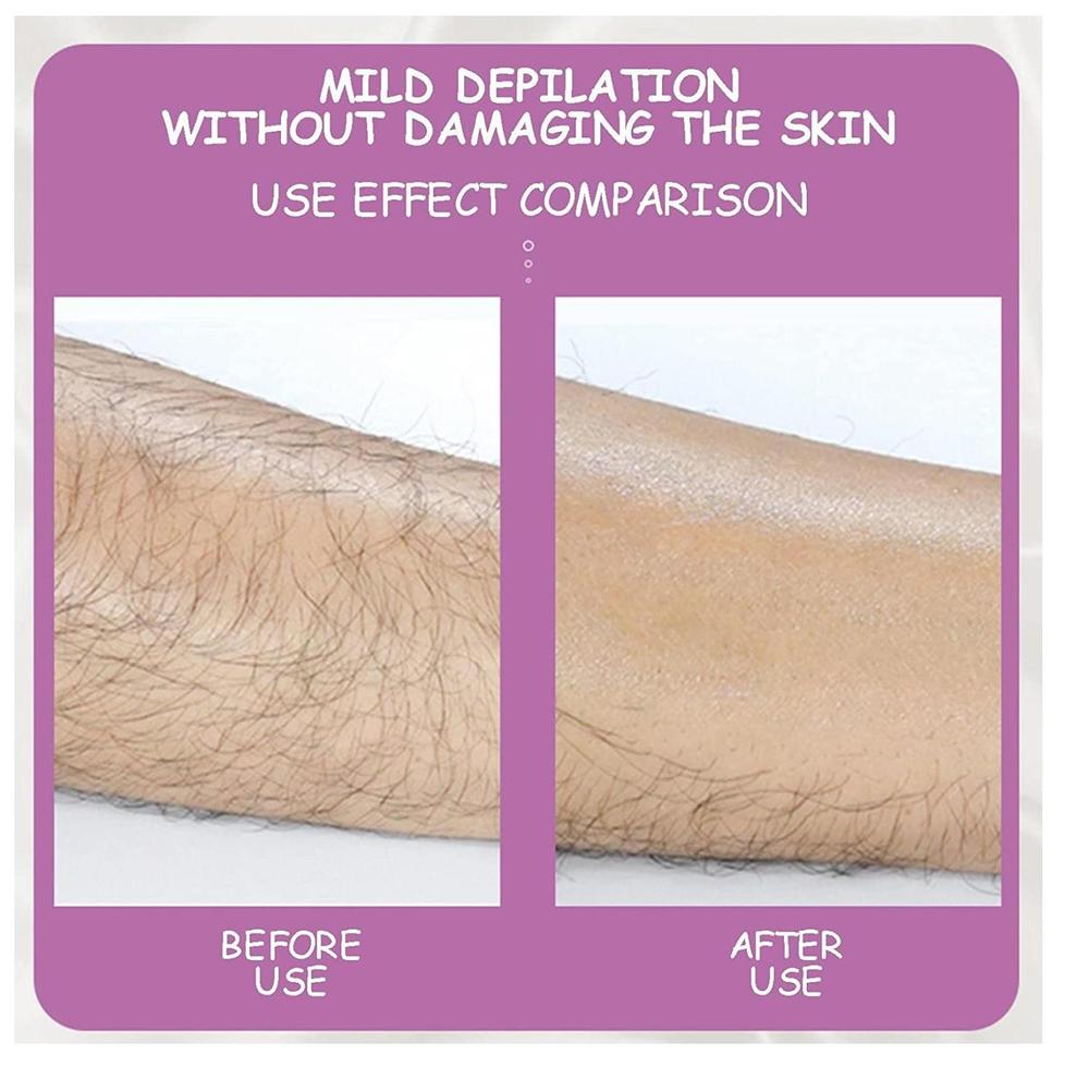 Painless Hair Removal And Horniness Removal - Image 2