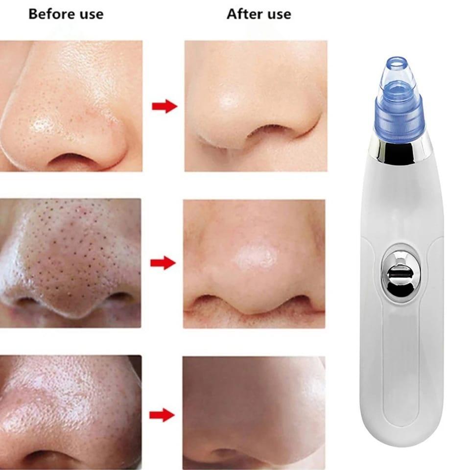 Derma Suction Facial Cleanser - Image 5