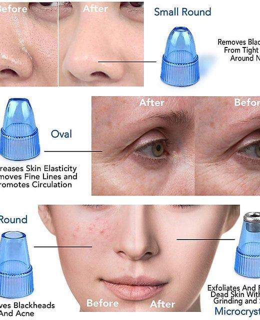 Derma Suction Facial Cleanser - Image 6